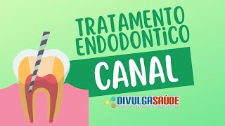 Endodontia | Como é feito o tratamento de canal?